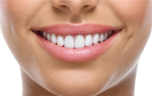 FACETAS DE PORCELANA E RESINA